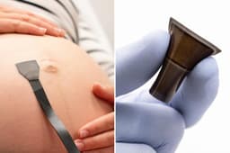 Wearable ultrasound patch can monitor high-risk pregnancies round the clock