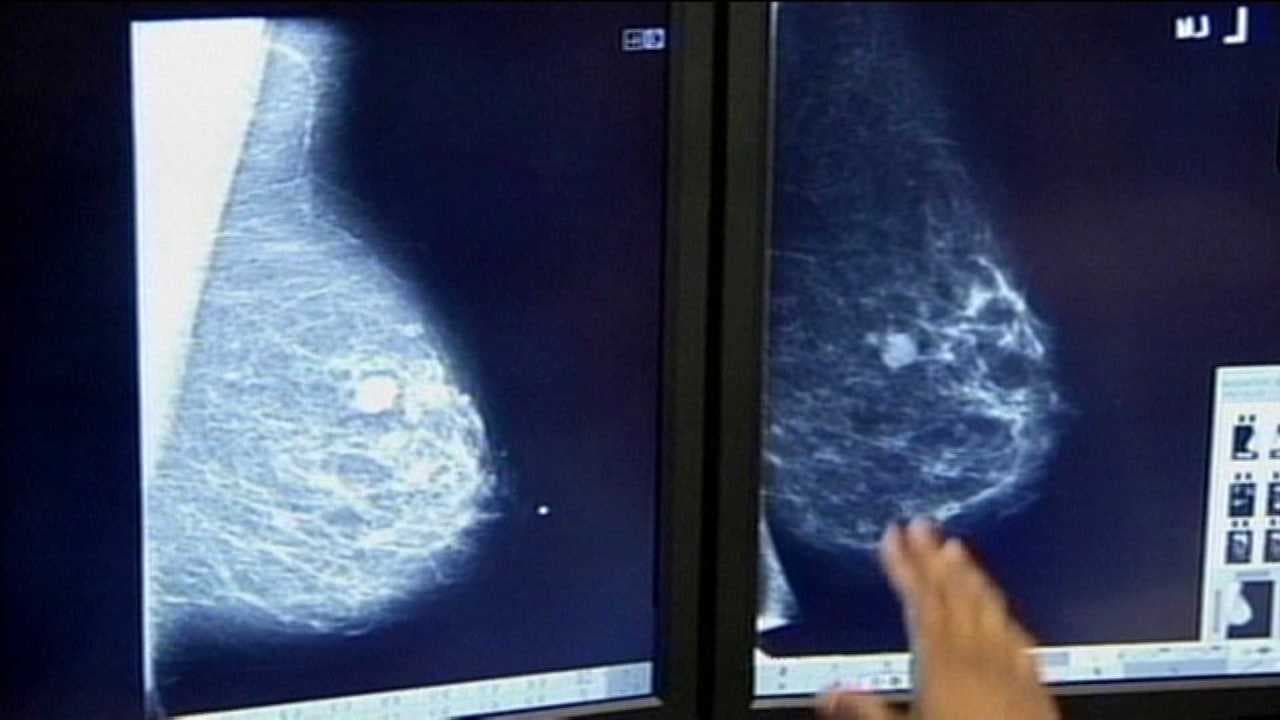 Why are Oklahoma women getting huge bills for a breast scan that should be 100% covered?