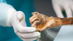 Unexpected Microbes on Ötzi the Iceman’s 5,300-Year-Old Body May Have Fed on Chemicals Used to Preserve Him