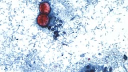 2 deaths reported in cyclosporiasis outbreak in Michigan ...