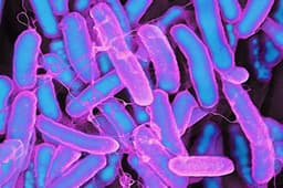 Two E. coli cases in San Diego County linked to The Kebab Shop statewide outbreak