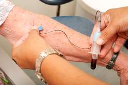 Rapid Alzheimer's testing arrives