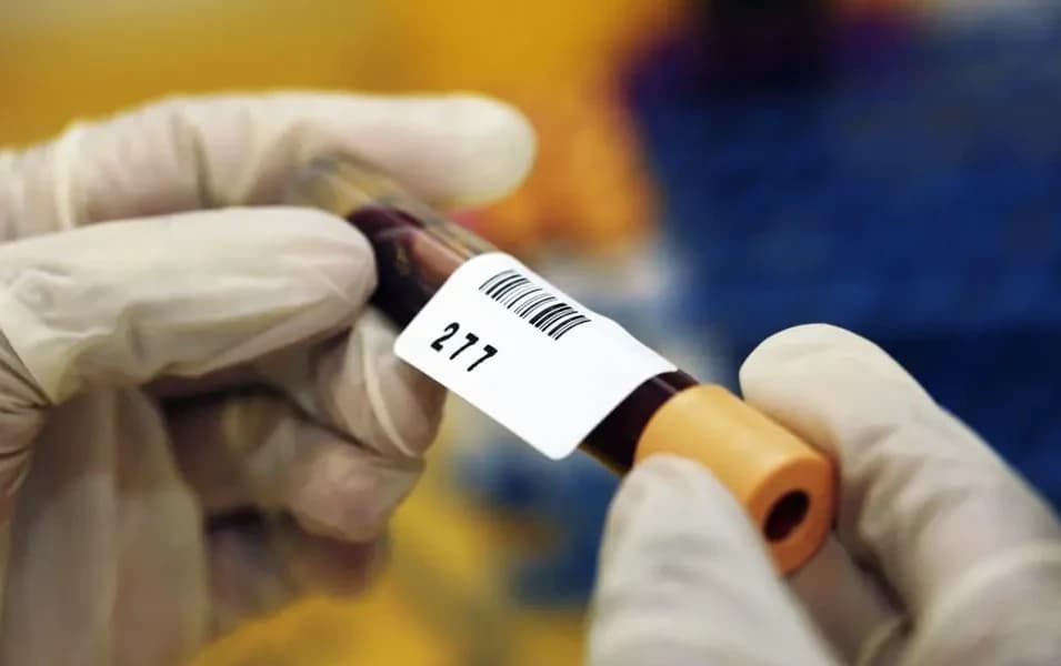 CE mark for p-Tau217 test boosts Alzheimer's early detection