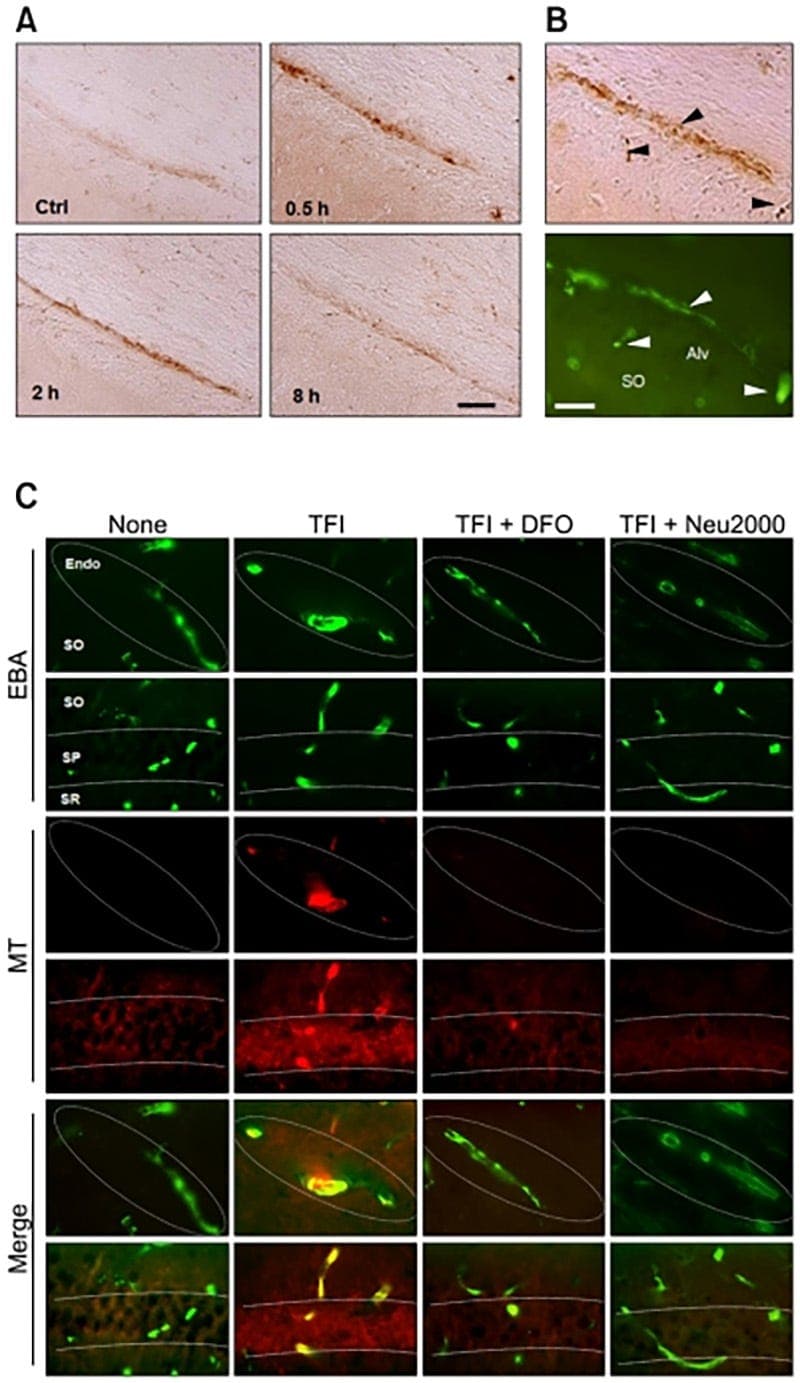 The Spike Protein, Ferritin and Long COVID: Additional Damage to the Microvasculature