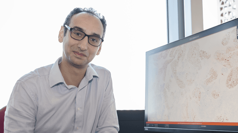 Genetic changes that accumulate as we age may contribute to autoimmunity | East Genomics