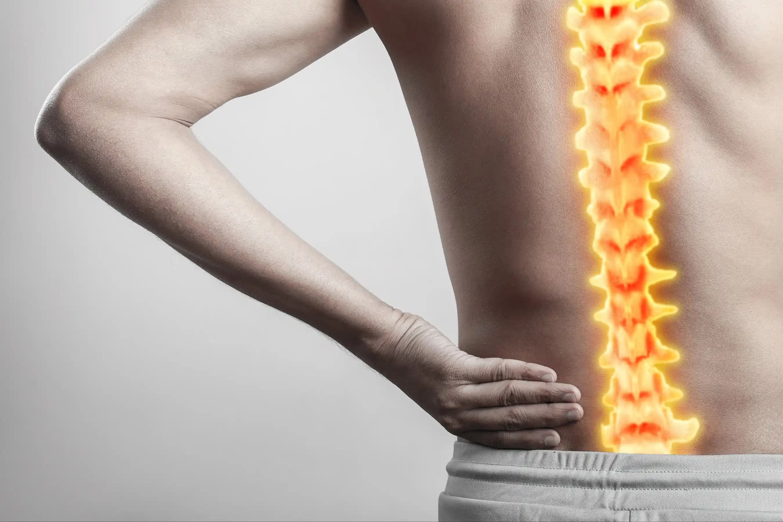 How Spinal Cord Stimulation Can Relieve Sciatica Pain