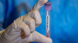 BREAKING: Hantavirus Genome Was Built from HUMAN BLOOD at U.S. Military Biolab 