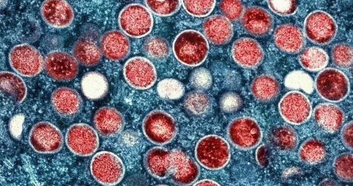Montana researchers accused of smuggling Monkeypox into the U.S. from the Republic of Congo