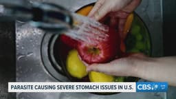 Health officials investigate parasite outbreak linked to contaminated food and water