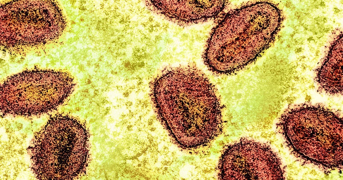 Foreign nationals working at NIH charged with smuggling monkeypox into US at Metro Airport