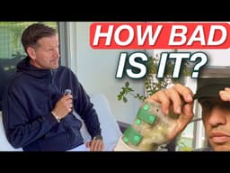 Alcaraz Pulls Out of Wimbledon | How Bad is His Wrist Injury?