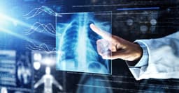 Large language model helps radiology department boost ...