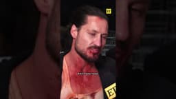 Where Val Chmerkovskiy Stands With Carrie Ann Inaba Amid #DWTS Return