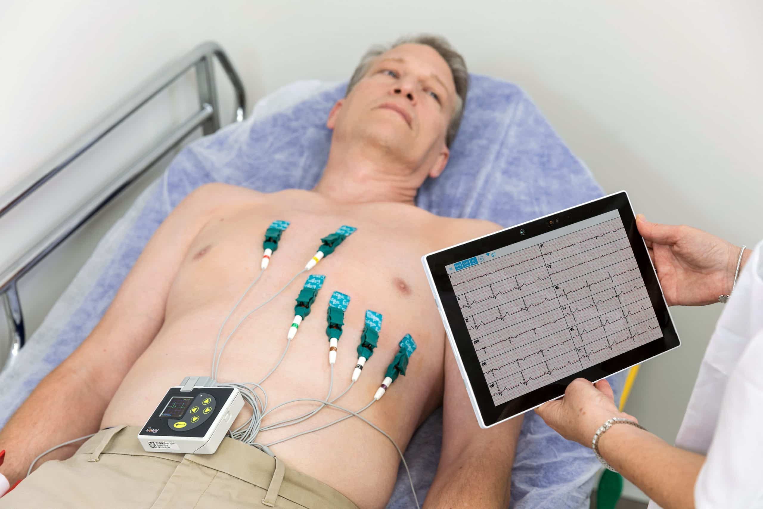 Cloud vs On-Premise ECG Data Hosting for Hospitals