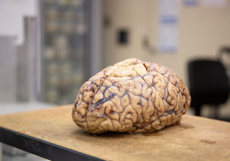 The Brain Health Accelerator Seeks to Revolutionize Neuroscience Research