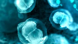 Noninvasive Diagnosis of Alzheimer's Disease: A Review ...