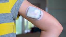 Insulet announces recall of Omnipod 5 Pods due to insulin delivery issue