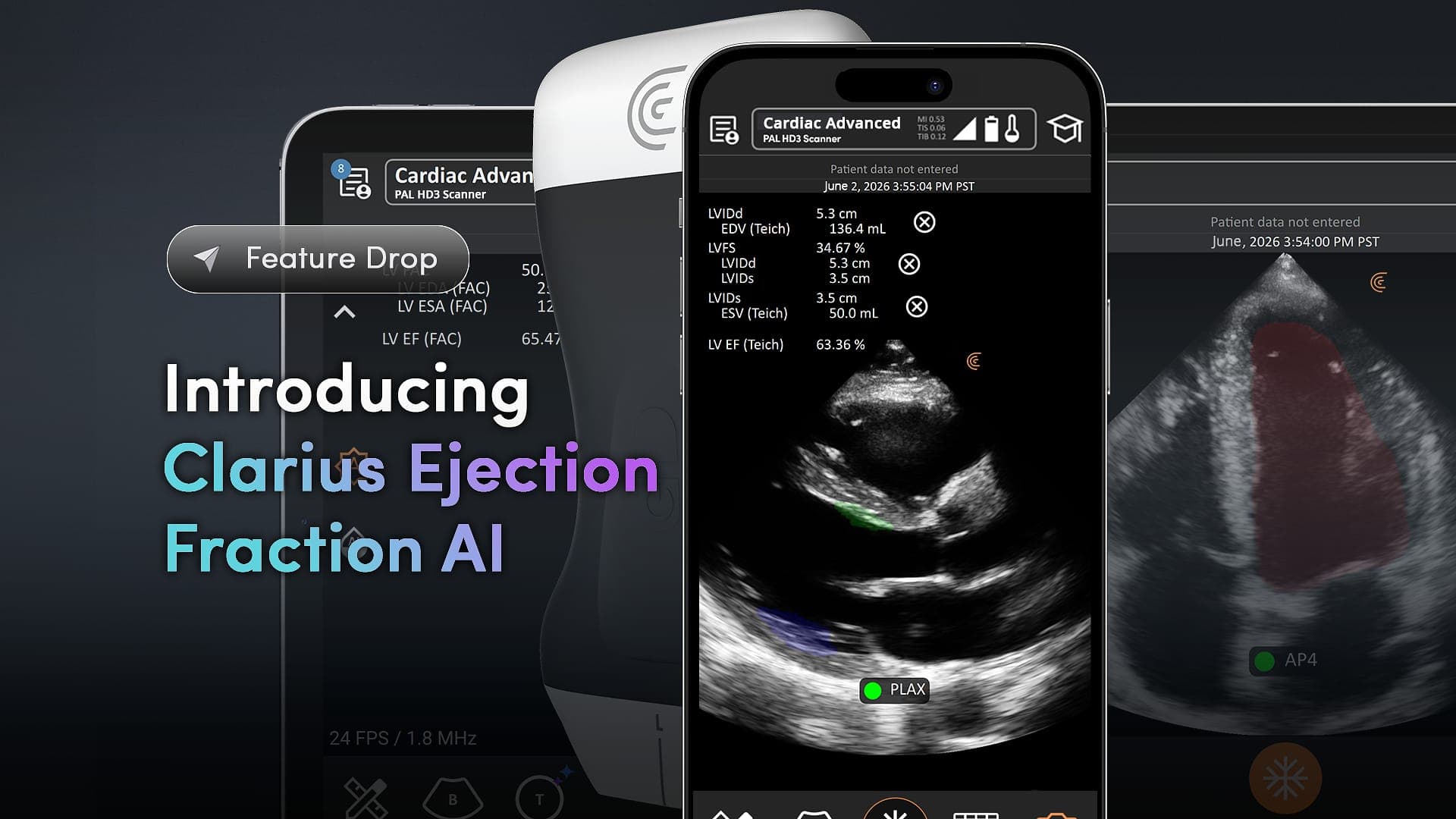 FDA Clears AI Tool That Automates Ejection Fraction Measurements