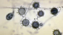 Histoplasmosis Outbreak Causes Illness