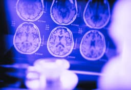 Can Creatine Help Alzheimer's? A Look at the Science