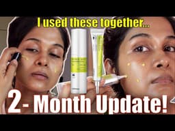 Viral Celimax Retinol + Retinal (Powerful Combo or Skin Overload?)