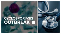 Cyclosporiasis cases more than triple in Michigan since ...