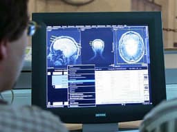 Blood biomarkers could detect earliest signs of Alzheimer’s disease – and slow its progression