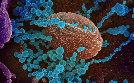 The Next Time: Pandemic Prevention, Preparedness, and Response | UCSF Institute for Global Health Sciences