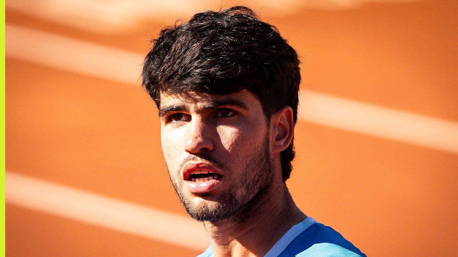 Alcaraz Likely to Withdraw from Wimbledon