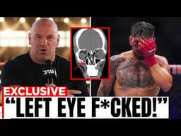 “LEFT EYE DESTROYED?!” Dana White Breaks Silence on Ilia Topuria's Injury