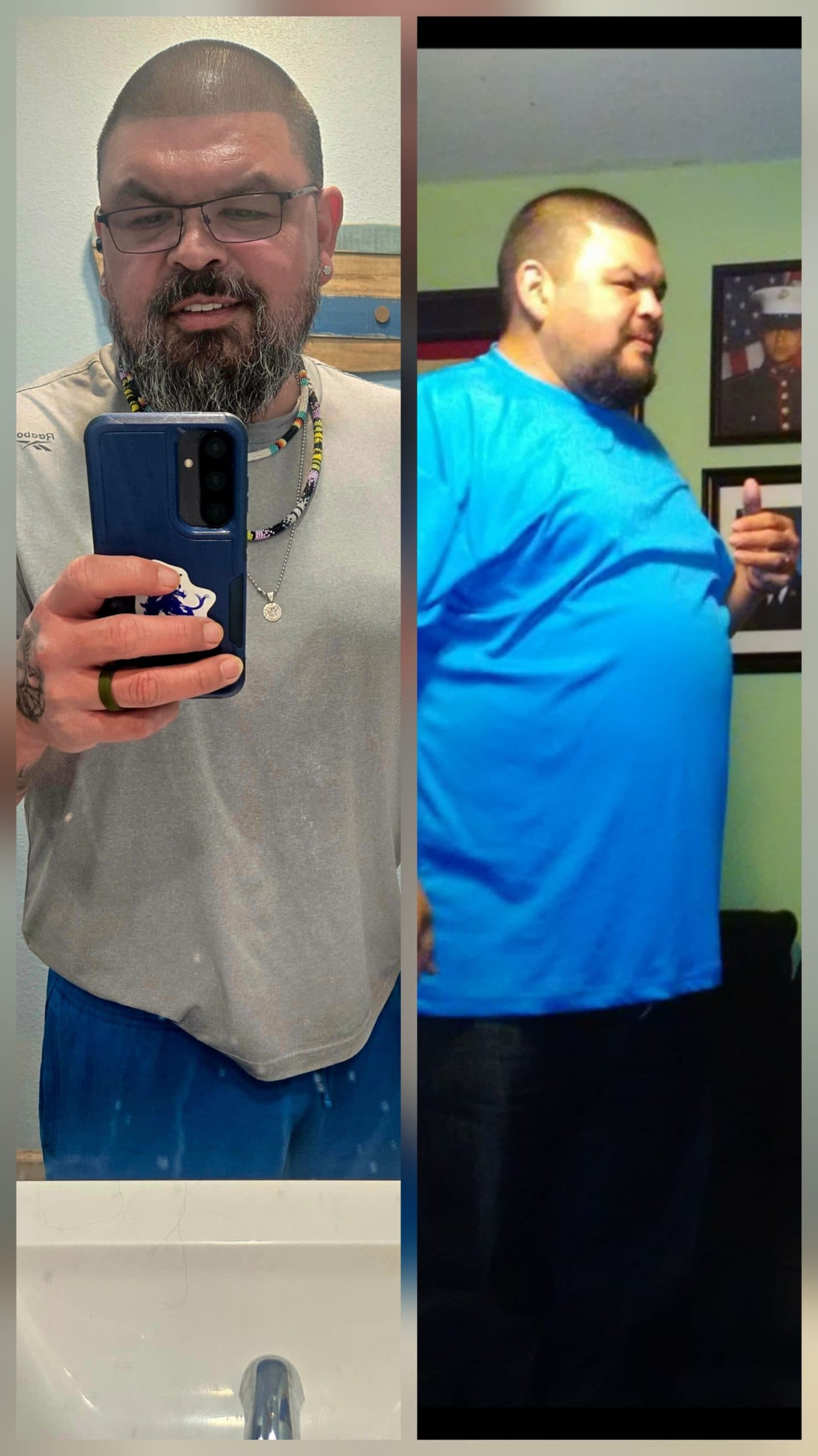 Plant-based Diet Convert Drops Weight and Need for Diabetes Medication