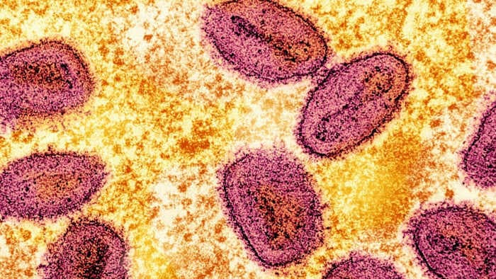 FBI: NIH scientists accused of smuggling monkeypox into US through Detroit Metro Airport