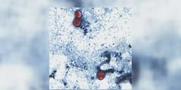 A state is now reporting 700+ cases of 'explosive' diarrhea ...