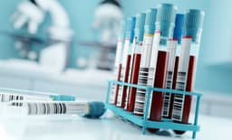 Alzheimer's Drug Effects Revealed with Plasma Biomarker ...