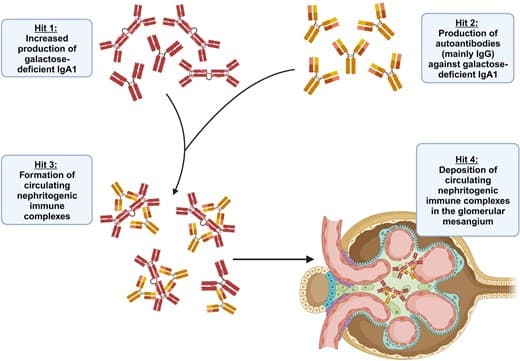 What do clinical trials teach us about the pathophysiology of human IgA nephropathy? | Nephrology Dialysis Transplantation | Oxford Academic