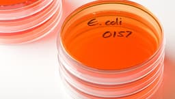 USDA posts warning about beef kofta linked to E. coli outbreak