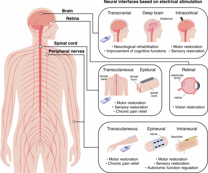 The optimization of neuroprosthetic interfaces relying on biophysical and surrogate digital twins | npj Biomedical Innovations