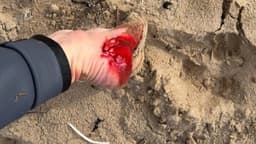 Middleton beach shark attack: Oliver Tokic-Bensley in lucky escape | The Advertiser