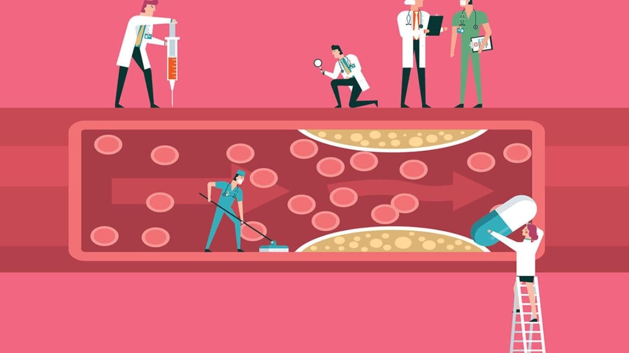 What doctors want patients to know about high cholesterol