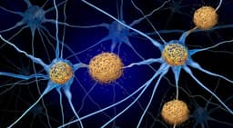 FDA Clears Roche Blood Test for Alzheimer's Amyloid ...