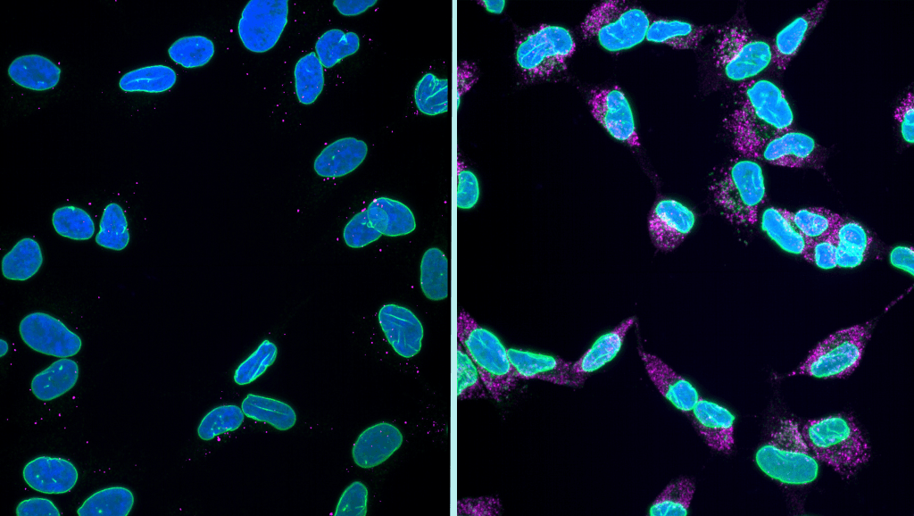 Scientists discover mechanism for brain cell death in ...