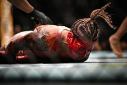 One fighter transported to hospital following bloody UFC Paris beating