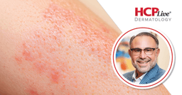 Strategies and Technologies for Acne Treatment in 2026, With Michael H. Gold, MD | HCPLive
