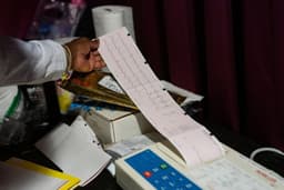 More Americans under 55 are dying of severe heart attacks