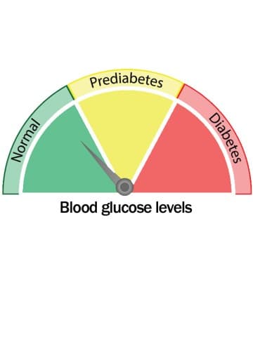 Normalising blood glucose in patients with prediabetes may reduce heart disease risk | Medicine Today