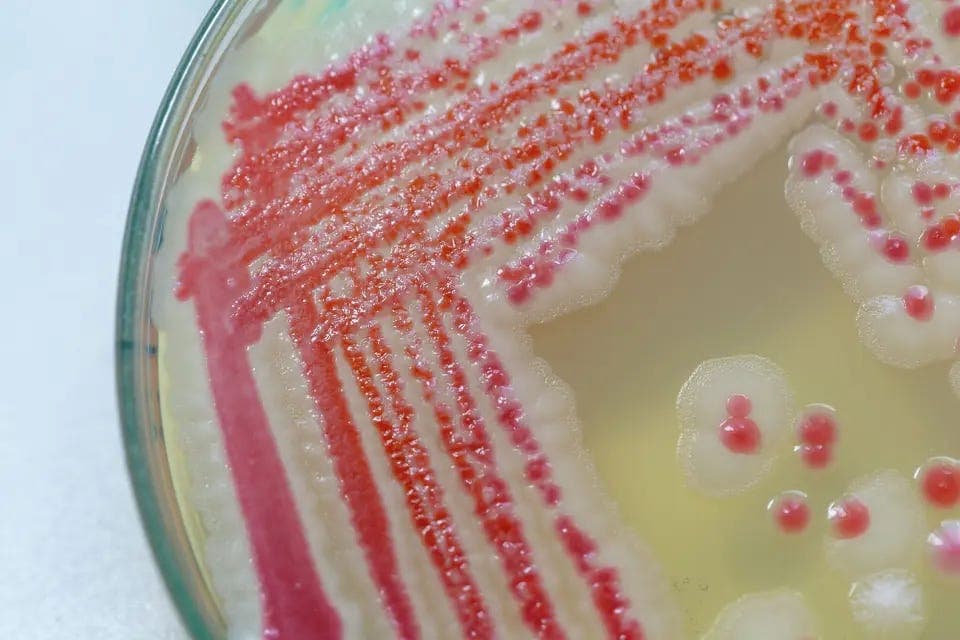 Serratia marcescens, this deadly bacteria & how it was deployed onto the American people UNKNOWINGLY in 1950s, alike Operation Mongoose: “In 1950, U.S. Army leadership decided the best way to protect 