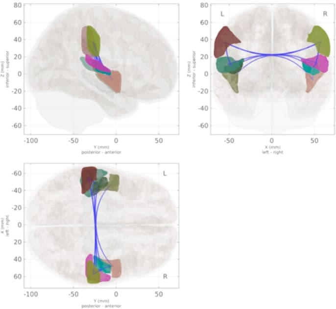 fMRI reveals postmenopausal brain connectivity shifts in ...