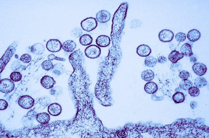 A MASSIVE SCAM: HANTAVIRUS PCR SEQUENCE MATCHES HUMAN DNA! 