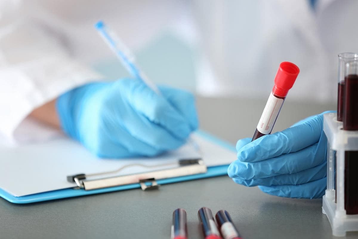 Simple Blood Test May Help Detect And Stage Alzheimer's Disease
