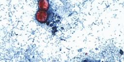 US health officials are investigating a new outbreak of a ...